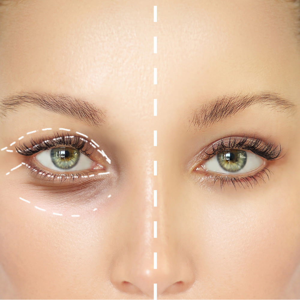 Rejuvenating Eye Complex 15ml